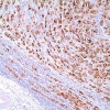 bca225