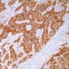 calretinin_poly