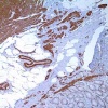 th_202m-9-ihc-01