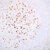 th_222a-1-ihc-01