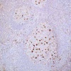 th_223a-1-ihc-01